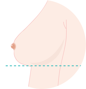 정상